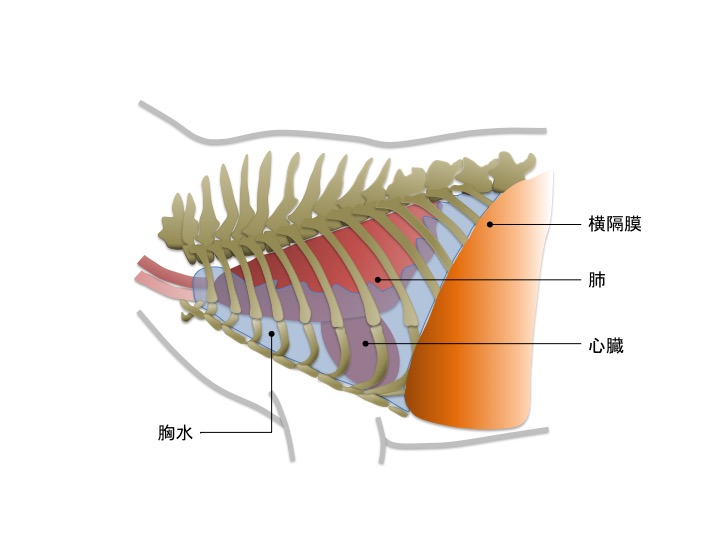 胸水貯留