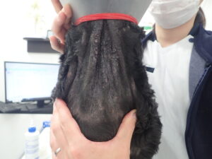 マラセチア皮膚炎