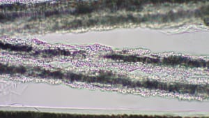 顕微鏡で観察された皮膚糸状菌02