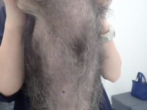 膿皮症02