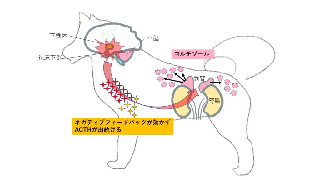 下垂体性クッシング症候群