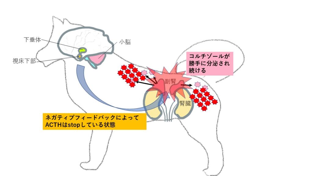 副腎腫瘍