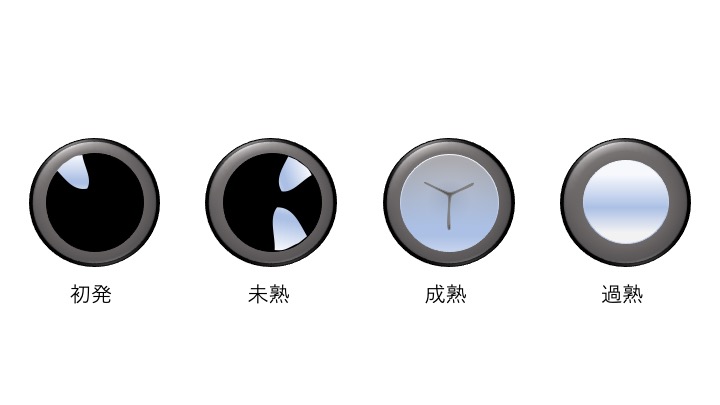 白内障の進行