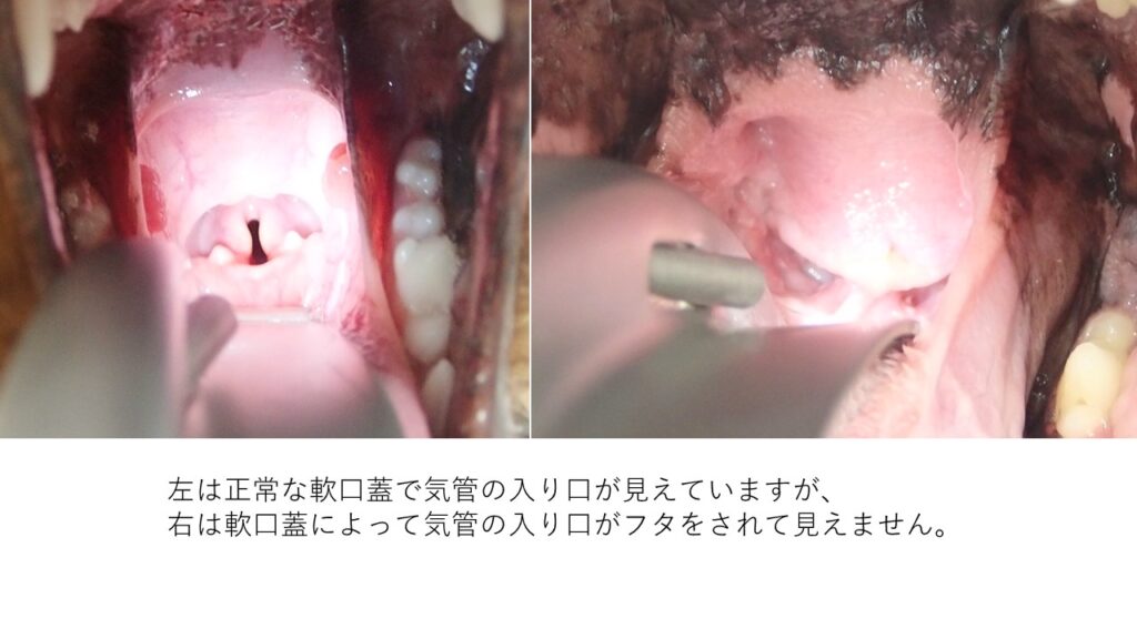 正常な軟口蓋と異常な軟口蓋