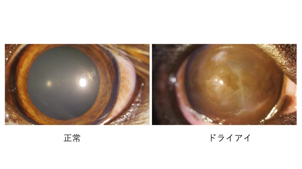 正常な眼球とドライアイの眼球