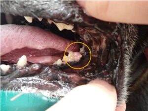 良性腫瘤