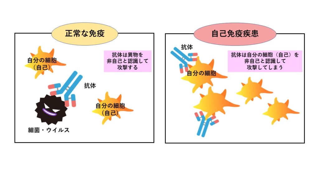 正常な免疫と自己免疫疾患
