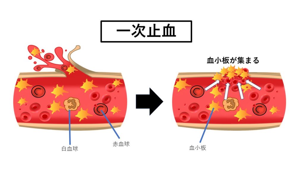 一次止血の様子