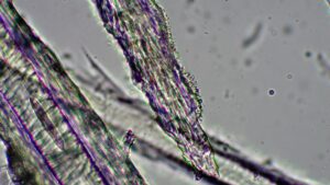犬の被毛に付着した皮膚糸状菌