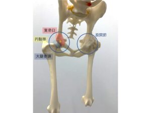 股関節脱臼