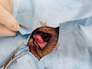 ポケット法による整復でポケット内に入れ込む前の状態