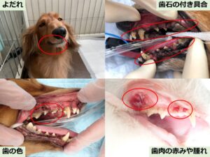 歯の病気にかかっているかチェックする時のポイント