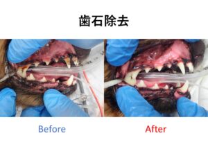 歯石除去を行う前と後