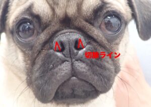 外鼻孔拡大手術前の写真