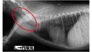 胸部X線検査