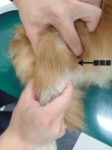 脛骨前方引き出し試験