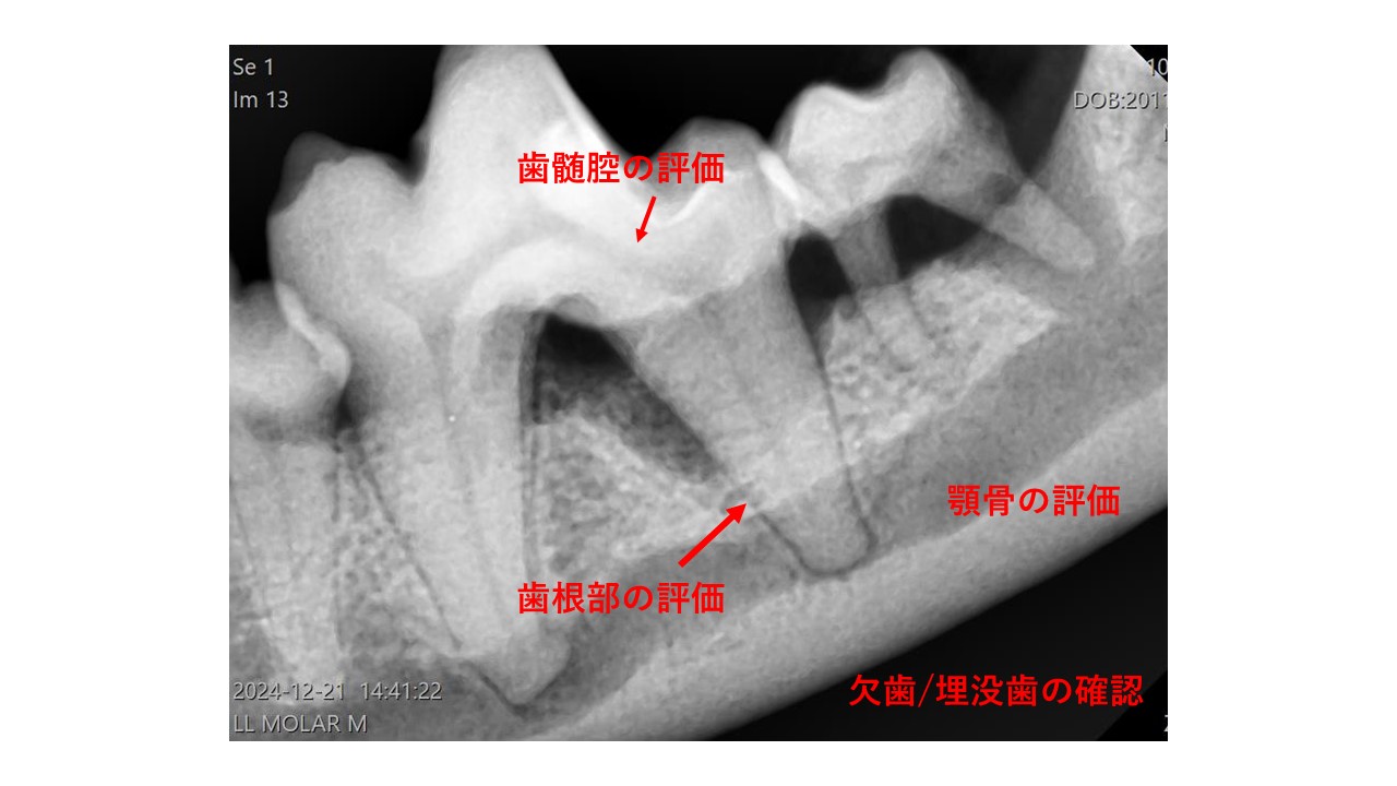 歯科用レントゲン装置での撮影