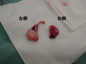 摘出した左右の精巣