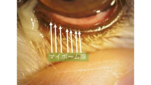 マイボーム腺