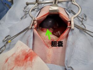 腹部の正中切開
